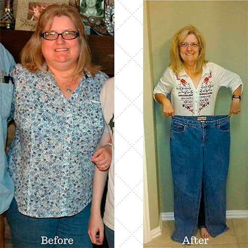 Before and after weight loss photos of a patient at Texas Medical Weight Loss Clinic