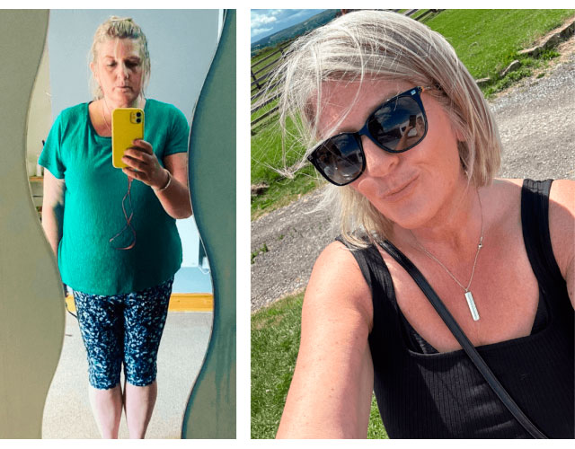 Before and after Gastric balloon - photos by Dr Zaher Toumi