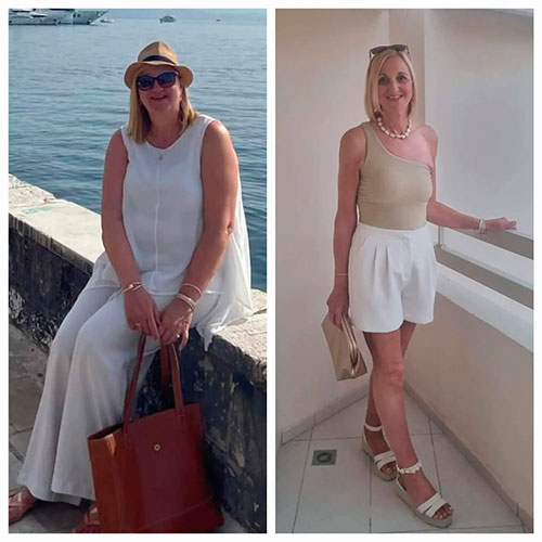 Before and after Gastric Bypass - photos by Dr Zaher Toumi