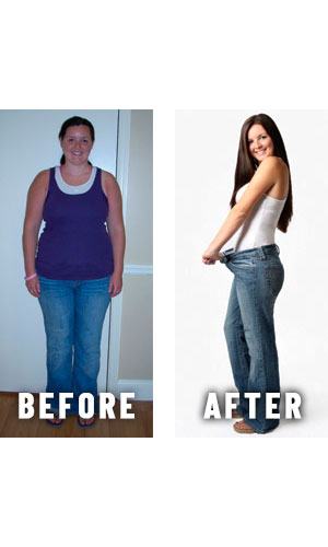 Before and after weight loss - photos by Physicians Weight Loss Centers