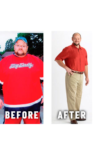 Before and after weight loss - photos by Physicians Weight Loss Centers