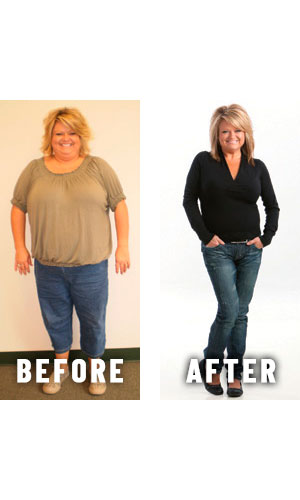 Before and after weight loss - photos by Physicians Weight Loss Centers