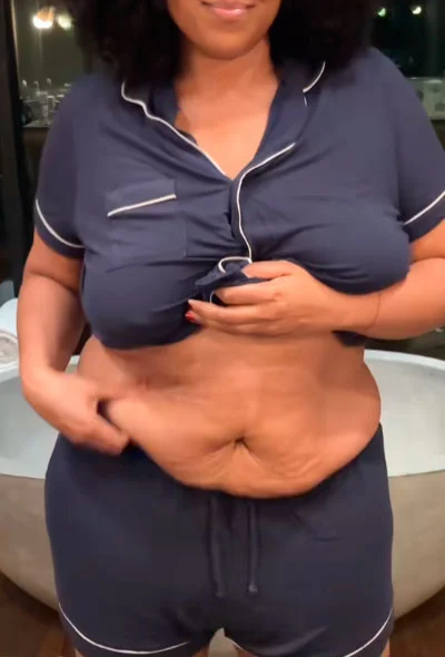 Lizzo's belly after weight loss
