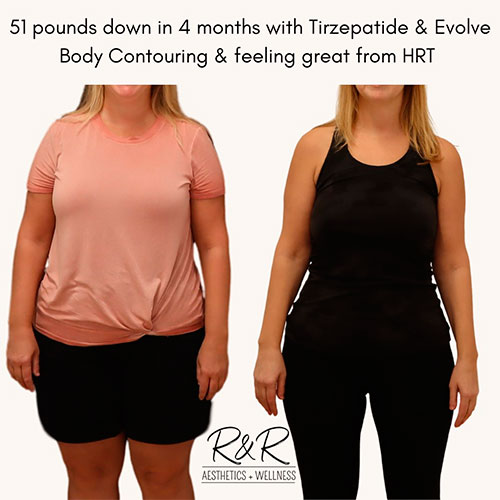 can i take advil on tirzepatide What to Expect After Starting Tirzepatide Injections