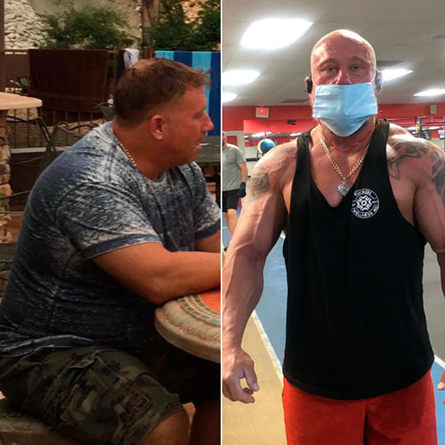 Weight loss before and after - photos by Tucson Wellness MD