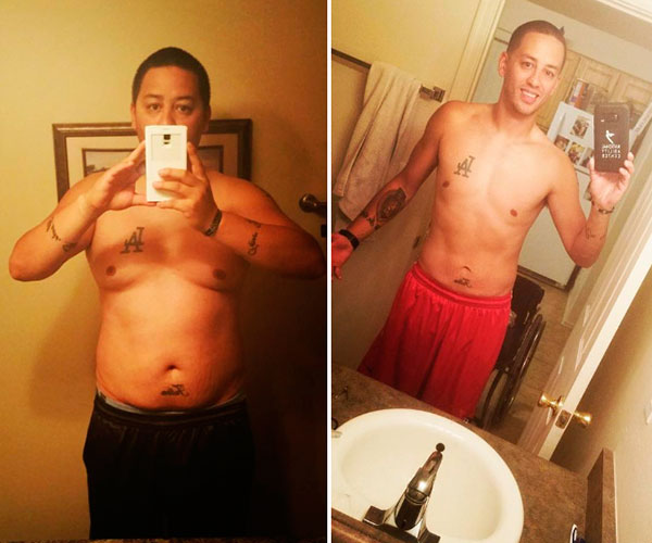 Weight loss before and after - photos by Tucson Wellness MD
