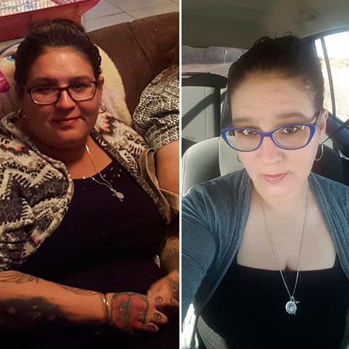 Weight loss before and after - photos by Tucson Wellness MD