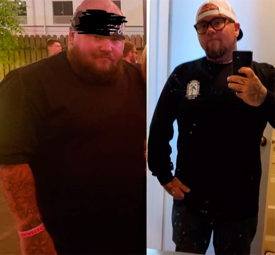 Weight loss before and after - photos by Tucson Wellness MD
