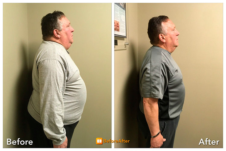 semaglutide warner robins ga 🌟 Experience Weight Loss Transformation with Semaglutide 🌟 🏥 Hello,  Pharmily 🏥 Ready to crush your weight loss goals? Introducing compounded  Semaglutide weekly Injections – your secret weapon for shedding those extra