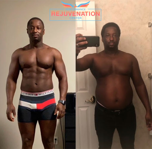 Hormone replacement therapy before and after - photos by Performance Rejuvenation Center