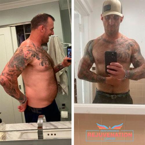 Testosterone replacement therapy before and after - photos by Performance Rejuvenation Center