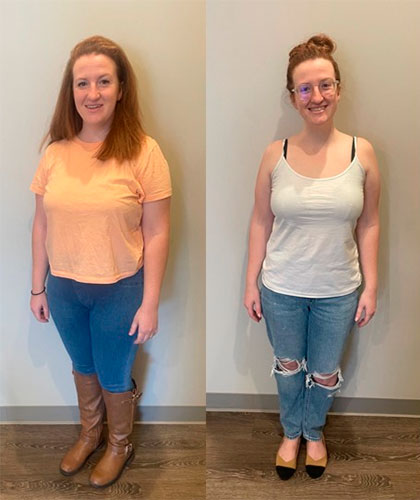 tirzepatide weight loss clinic alpharetta Tirzepatide Before and After: Photos and Results