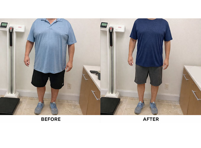 Weight loss program before and after - photo by Off Weight Loss Solutions