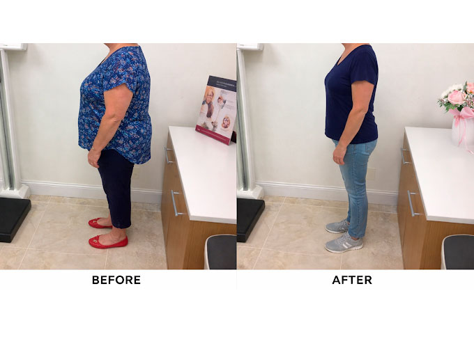 Weight loss program before and after - photo by Off Weight Loss Solutions