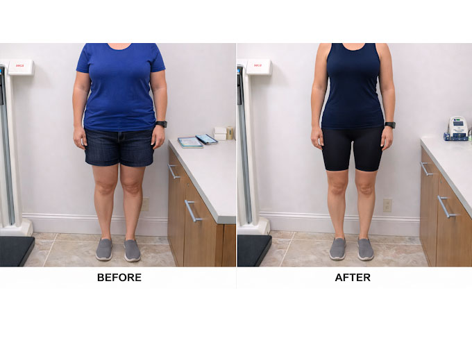 Weight loss program before and after - photo by Off Weight Loss Solutions