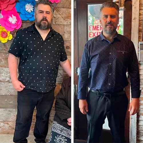 Weight loss program before and after - photos by Texas Weight Loss