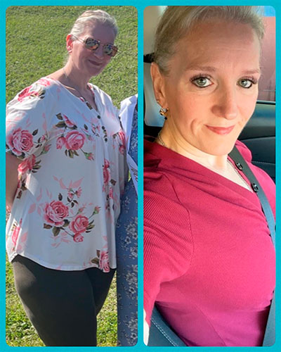 Weight loss program before and after - photos by Texas Weight Loss