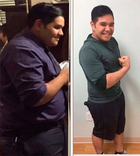 Weight loss program before and after - photos by Texas Weight Loss