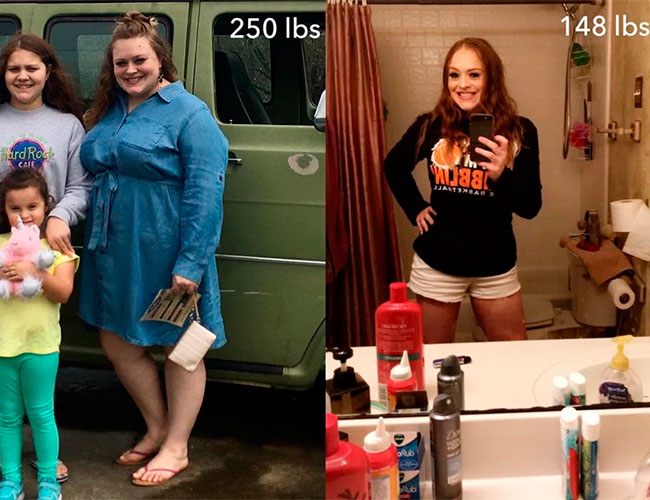 Weight loss program before and after - photos by Texas Weight Loss