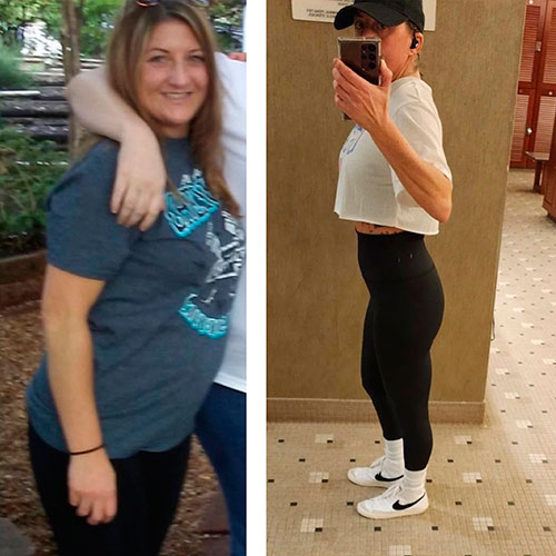 Weight loss program before and after - photos by Texas Weight Loss