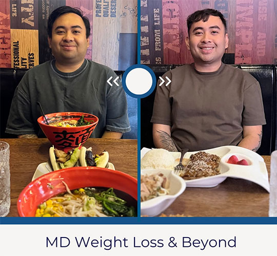 Diet before and after - photos by MD Weight Loss & Beyond