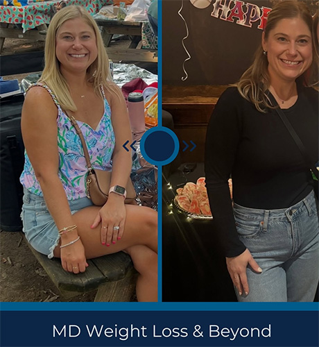 Weight loss program before and after - photos by MD Weight Loss & Beyond