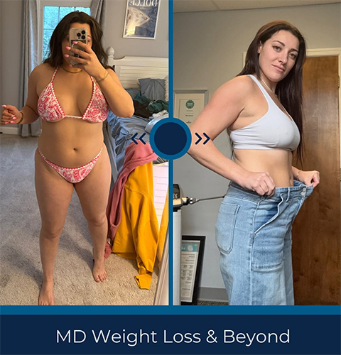 Weight loss program before and after - photos by MD Weight Loss & Beyond