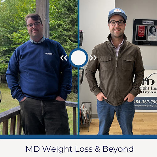 Weight loss program before and after - photos by MD Weight Loss & Beyond
