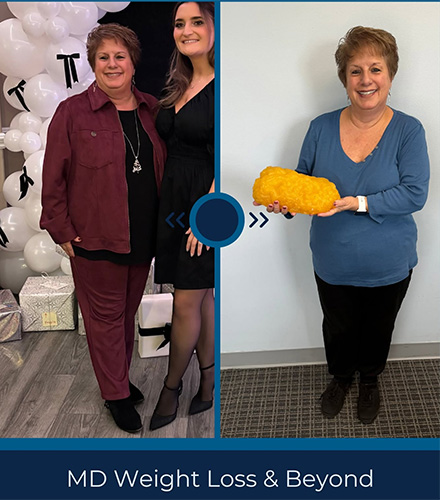 Zepbound before and after - photos by MD Weight Loss & Beyond