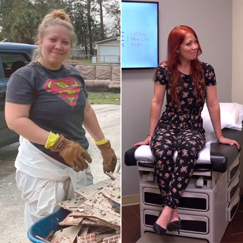 Bariatric surgery before and after - photos by New Life Surgical Associates
