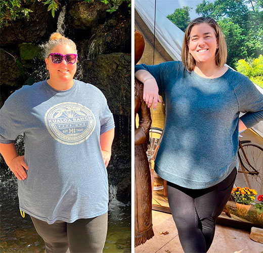 Bariatric surgery before and after - photos by New Life Center for Bariatric Surgery